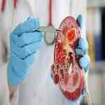 Kidney Diseases Specialist