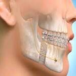 Oral, Dental & Maxillofacial Specialist